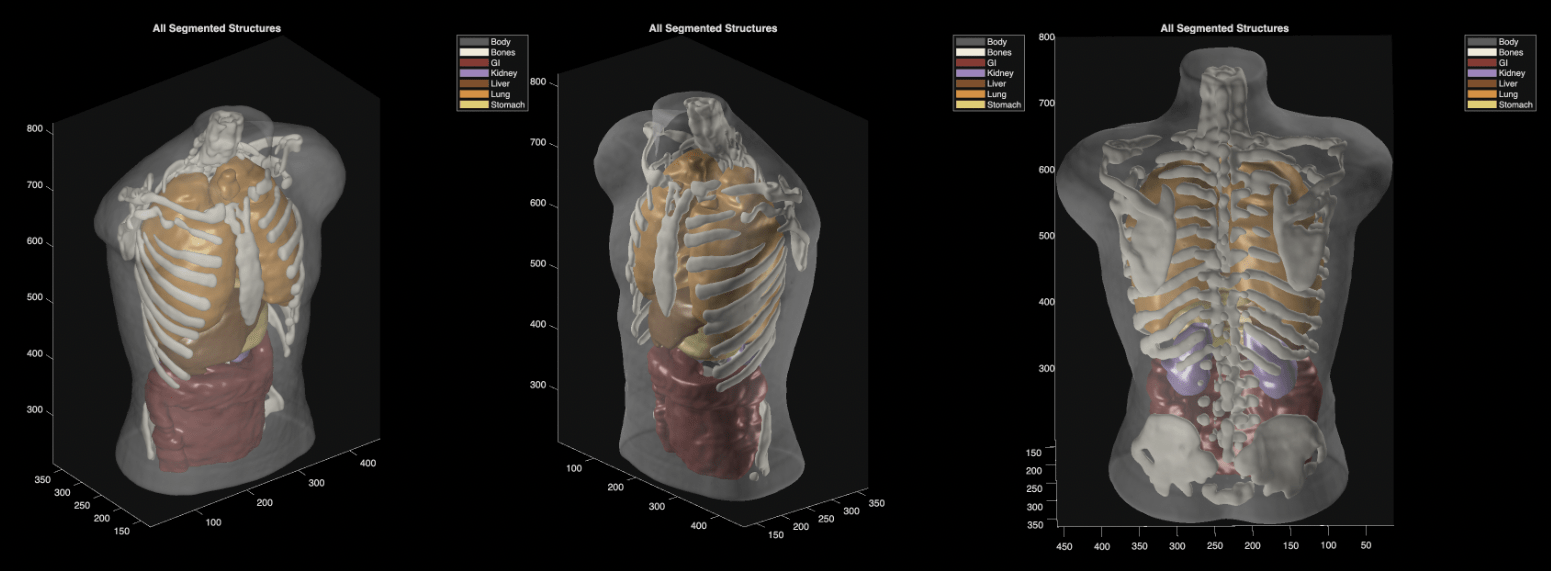 Midjourney Medical goes from generating ‘cat images’ to full-body ultrasound scans