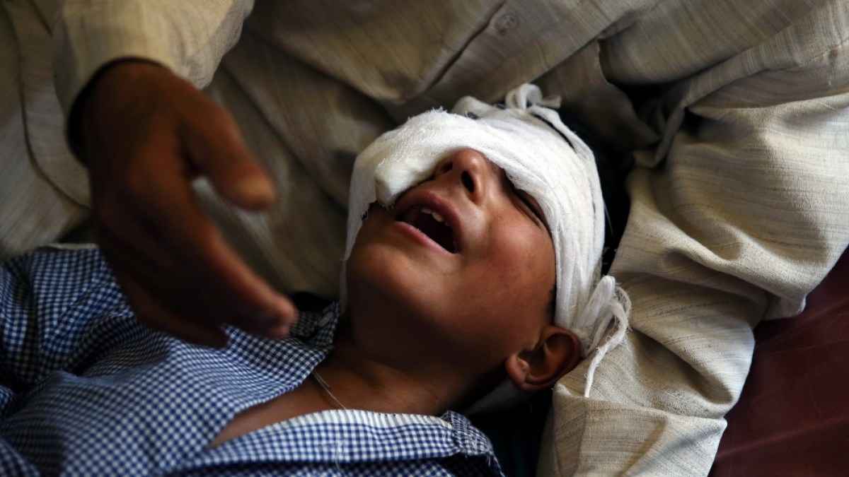 ‘Limited damage’: Upcoming Bollywood film angers Kashmir pellet gun victims
