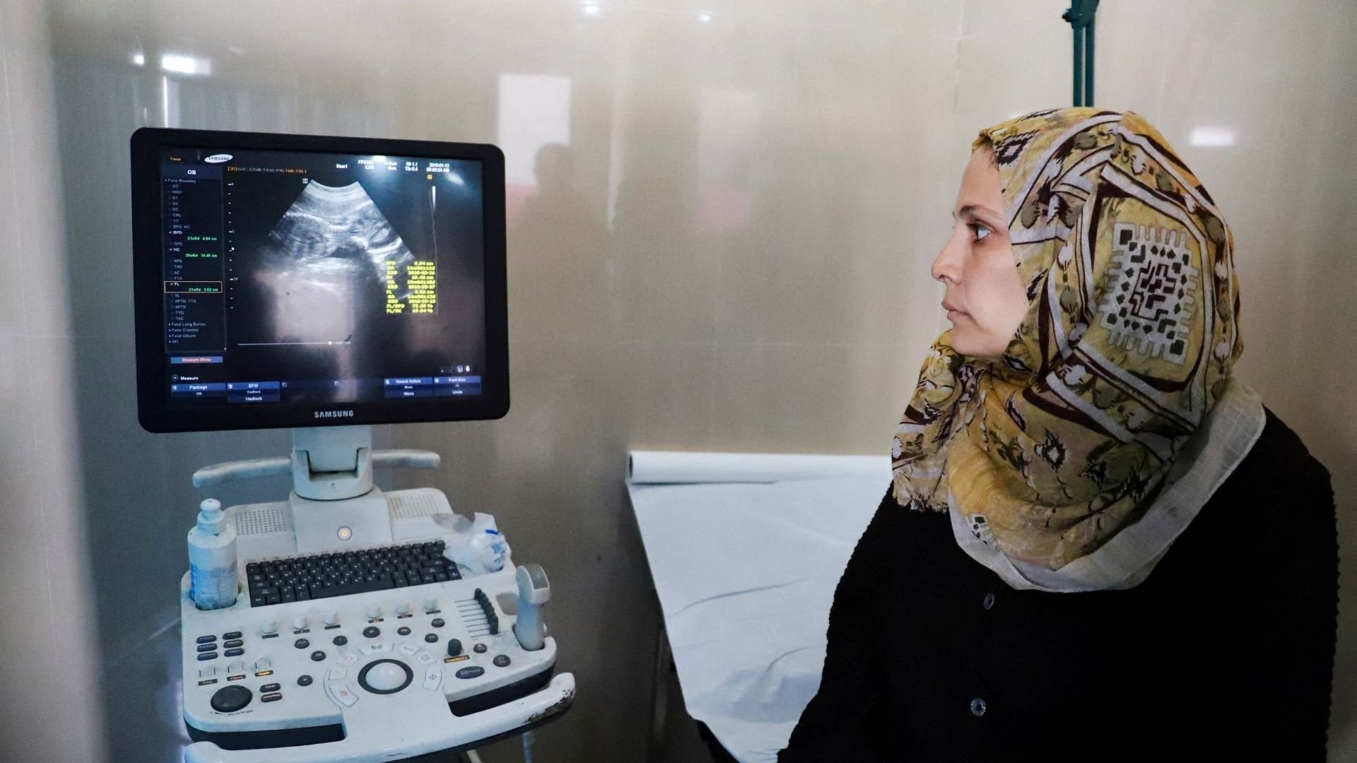 ‘The dream I carried is gone’: Miscarriages rise amid trauma of Gaza’s war