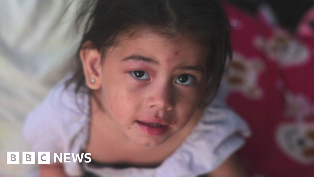 Watch: Inside the Venezuela country club now a makeshift hospital