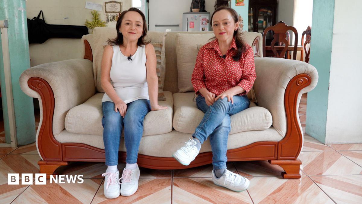 How these twins' rare growth disorder could provide the key to preventing cancer