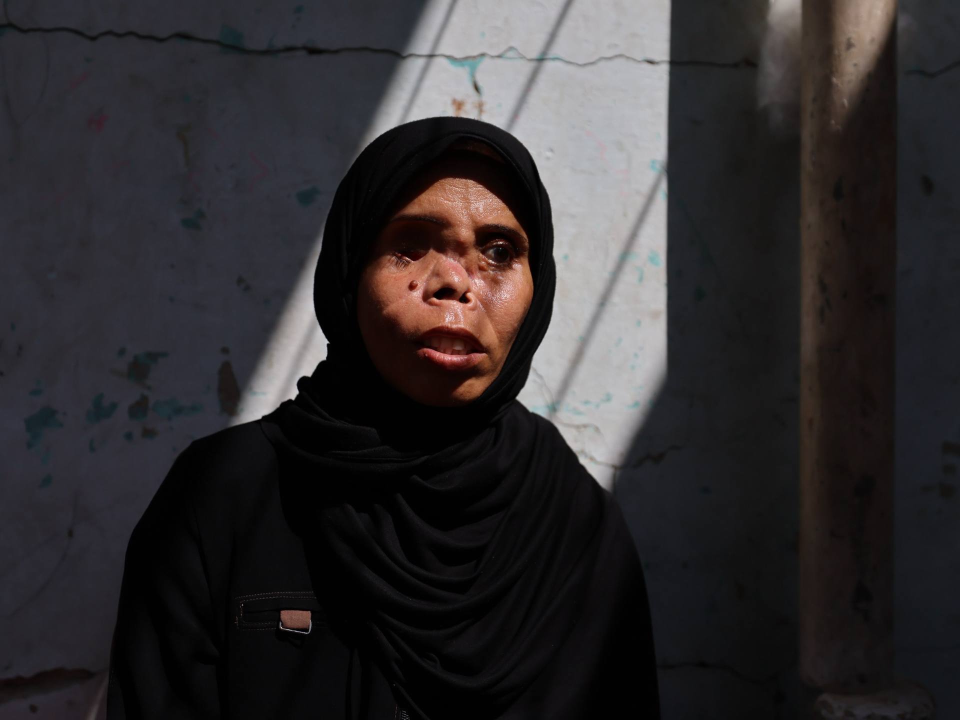 In Gaza, a long path to recovery for one woman who lost eye, and daughter